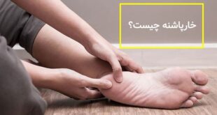 دعای مجرب رفع خار پاشنه پا و درمان و شفای قطعی خار پاشنه