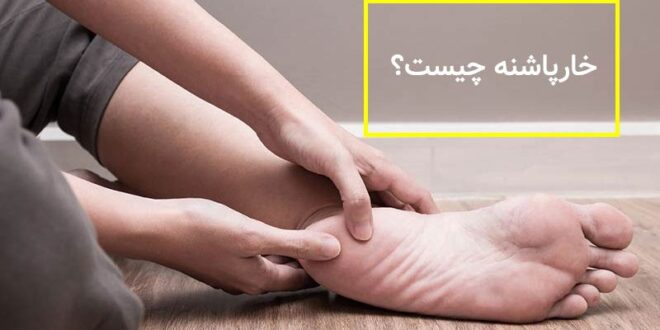 دعای مجرب رفع خار پاشنه پا و درمان و شفای قطعی خار پاشنه