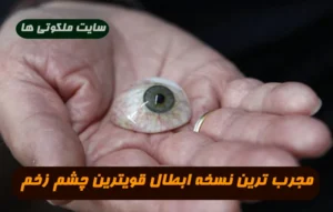 مجرب ترین نسخه ابطال قویترین چشم زخم و در امان ماندن از شر چشم زخم