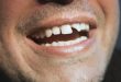 تعبیر خواب افتادن دندان همراه با خونریزی - تعبیر ریزش دندان