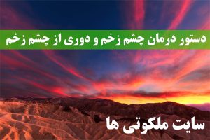 دستور درمان چشم زخم و دوری از چشم زخم - ذکر دفع چشم زخم