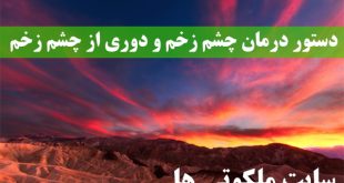 دستور درمان چشم زخم و دوری از چشم زخم - ذکر دفع چشم زخم